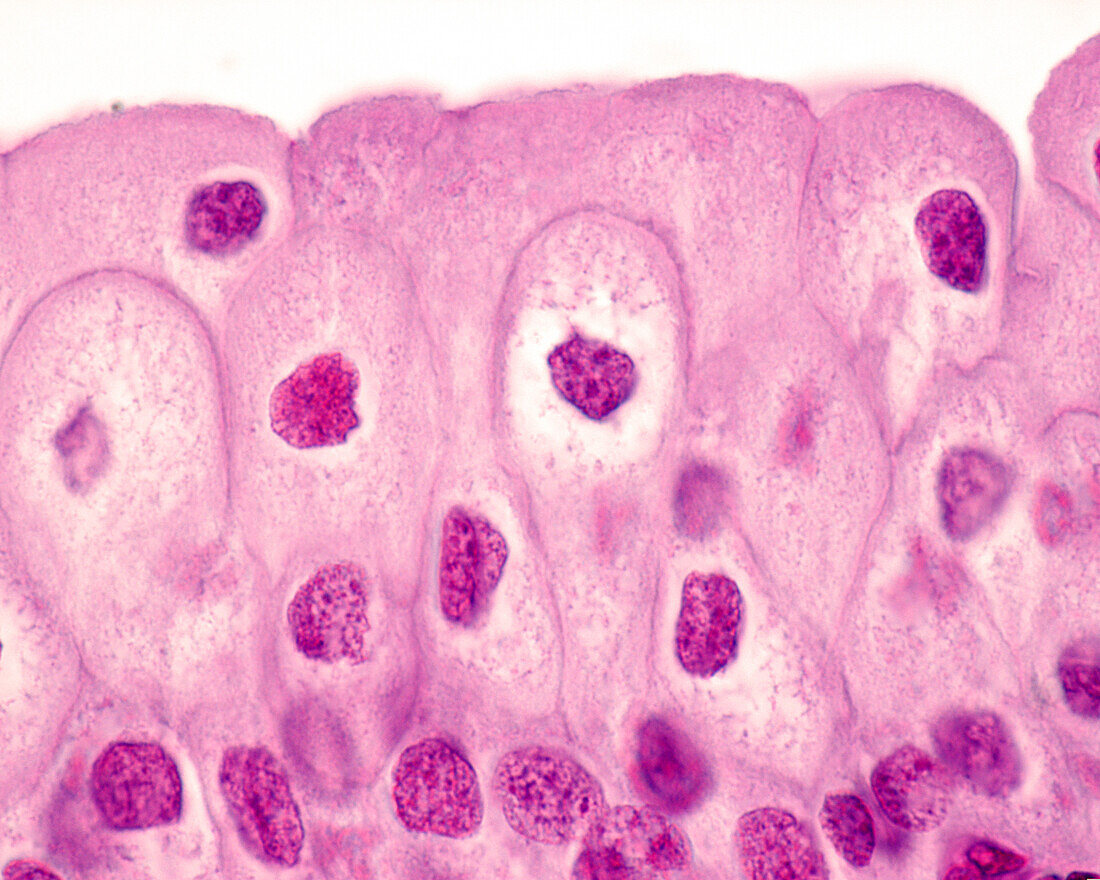 Urinary bladder epithelium, light micrograph