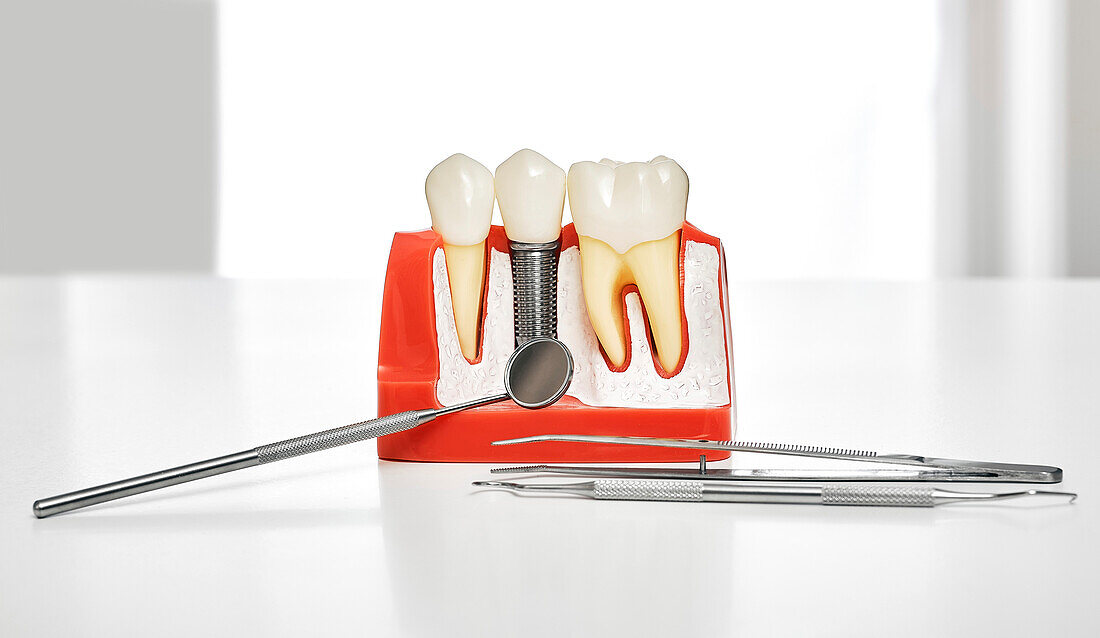 Dental treatment, conceptual image