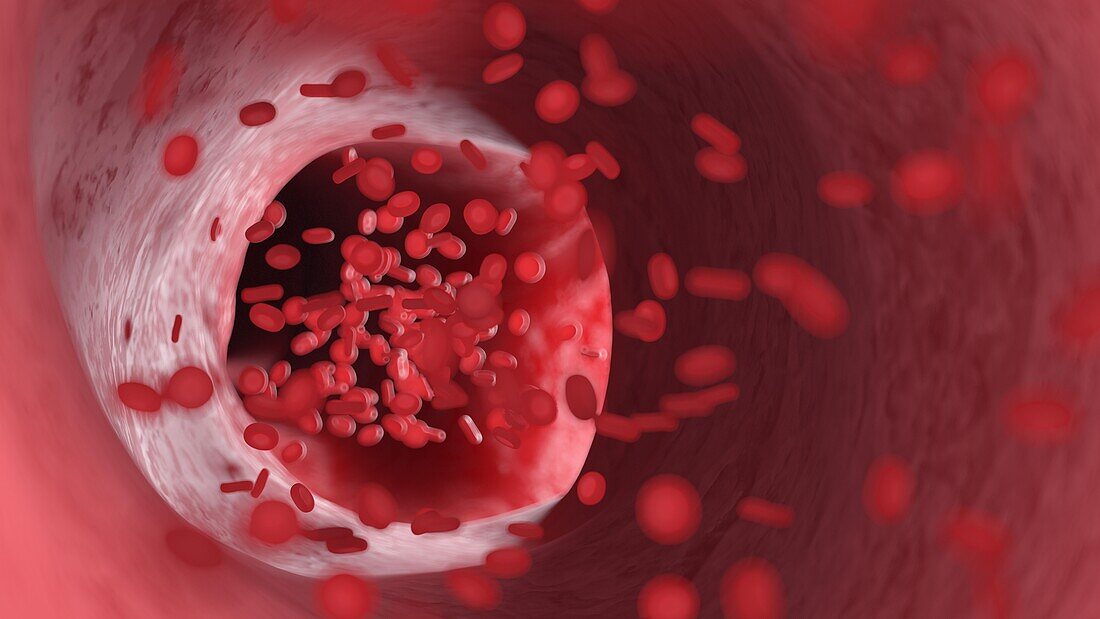 Red blood cells flowing through an artery, illustration