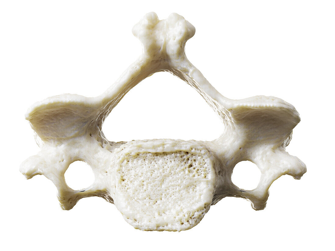 Cervical vertebrae, illustration