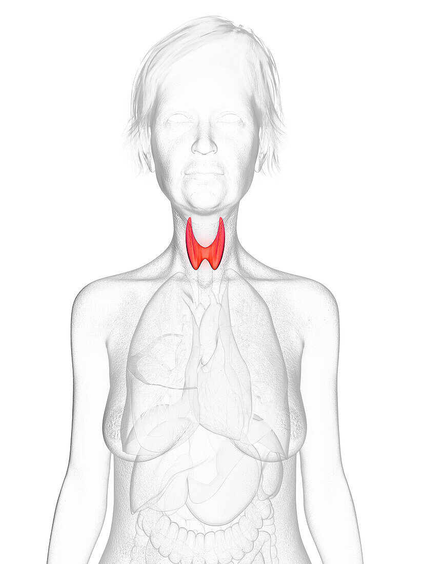 Elderly woman's thyroid gland, illustration