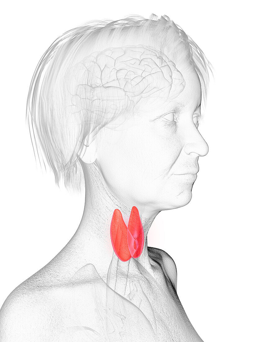 Elderly woman's thyroid gland, illustration