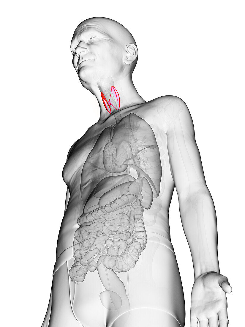 Elderly man's thyroid, illustration