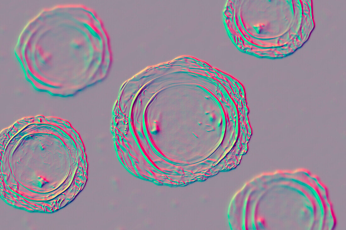 Eggs of Ascaris lumbricoides parasite, illustration