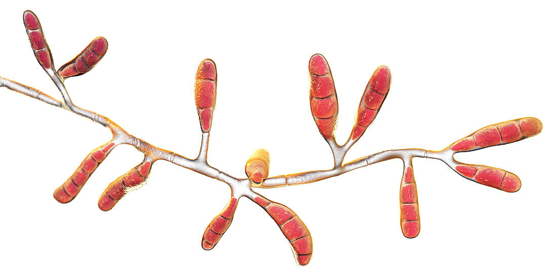 Dermatophyte fungus Epidermophyton floccosum, illustration