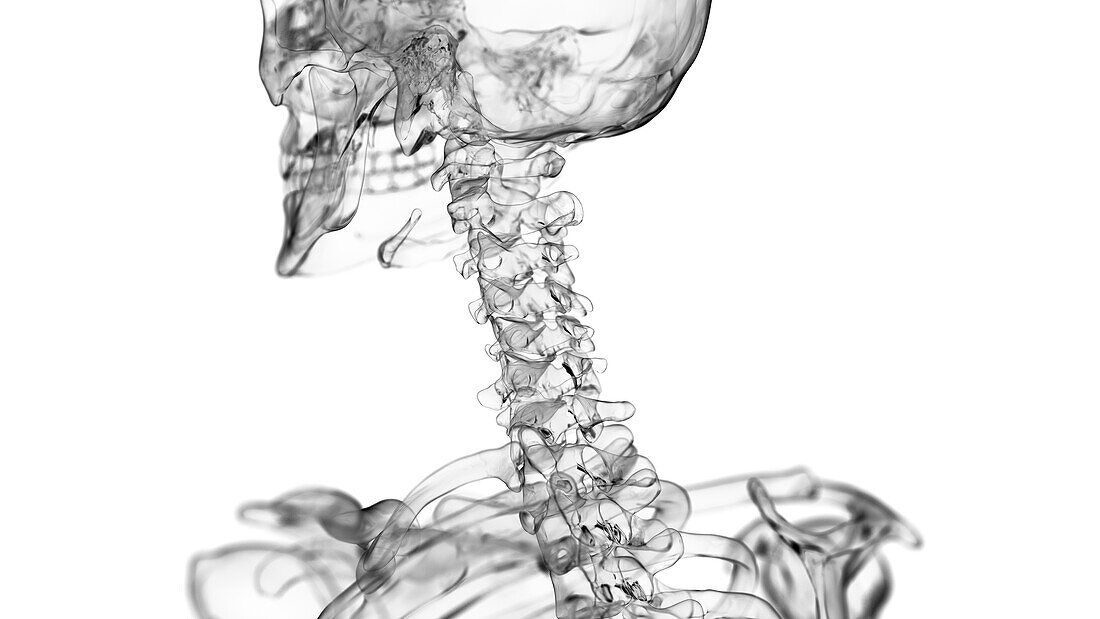 Neck joint, illustration