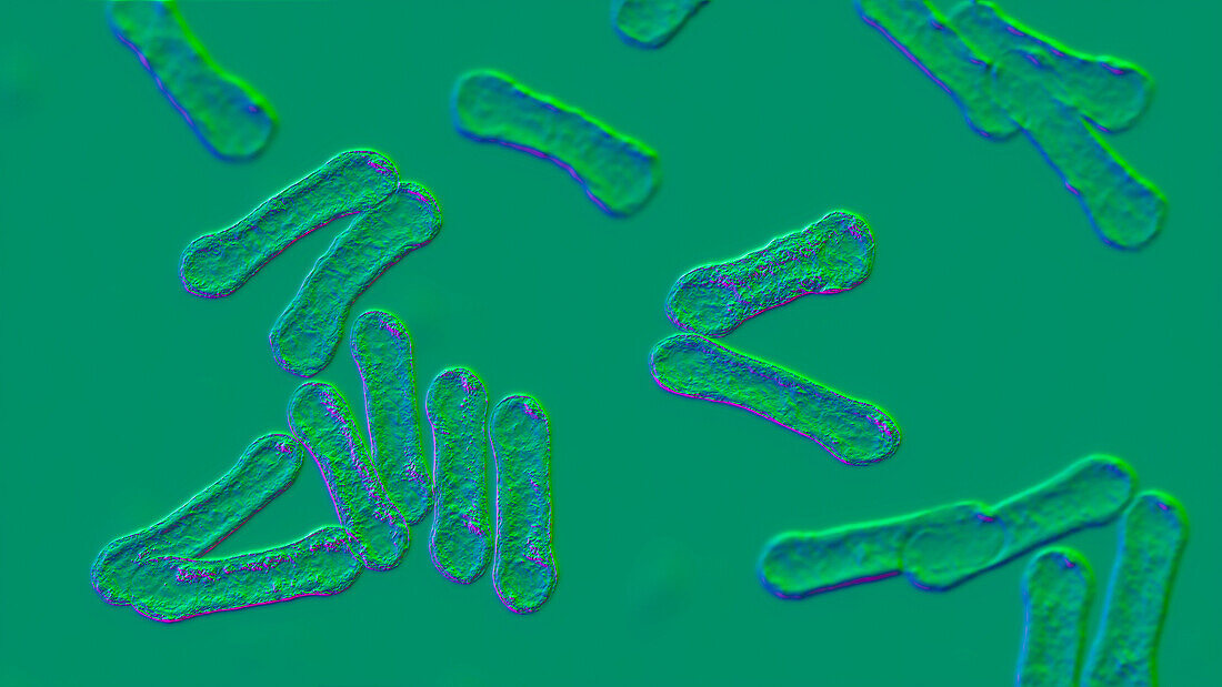 Corynebacterium diphtheriae, illustration