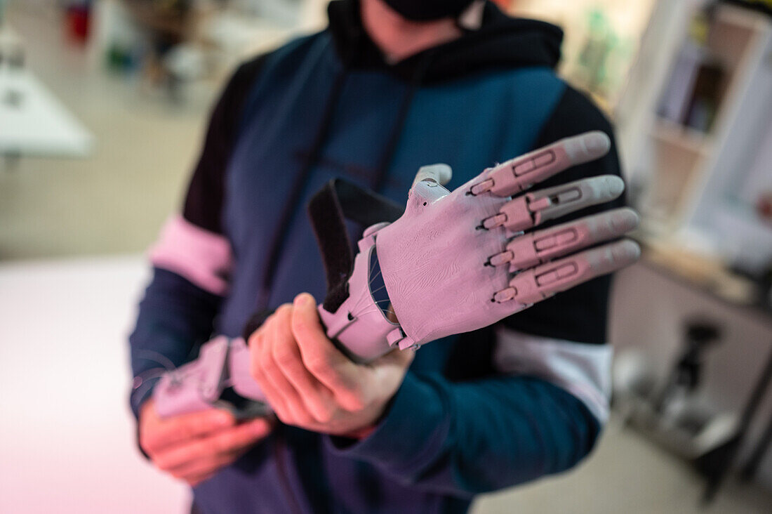 Man holding a 3D printed plastic arm prosthesis