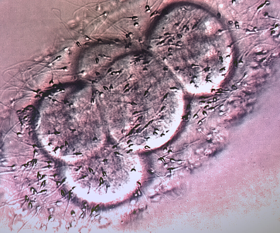 IVF treatment, light micrograph