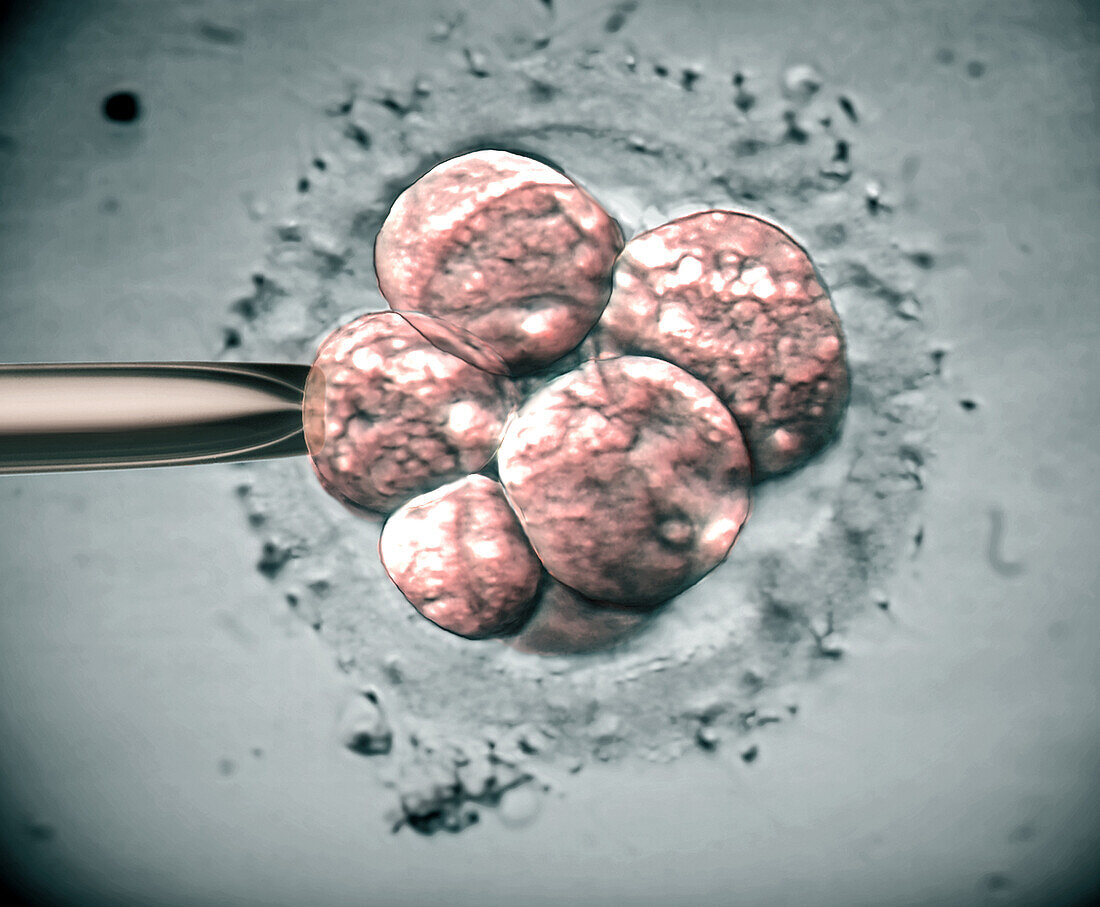 IVF embryo, light micrograph
