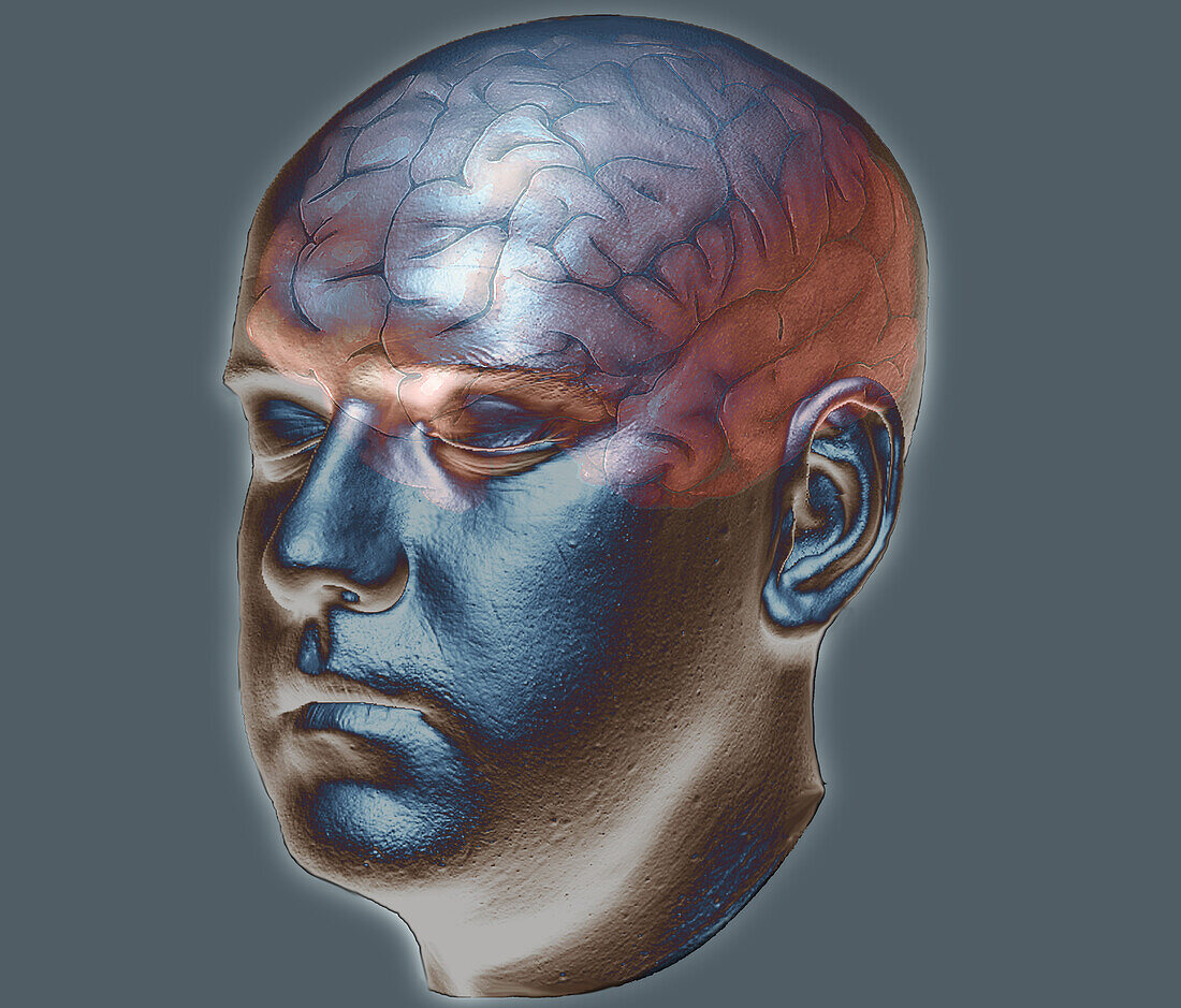 Normal brain, 3D CT scan