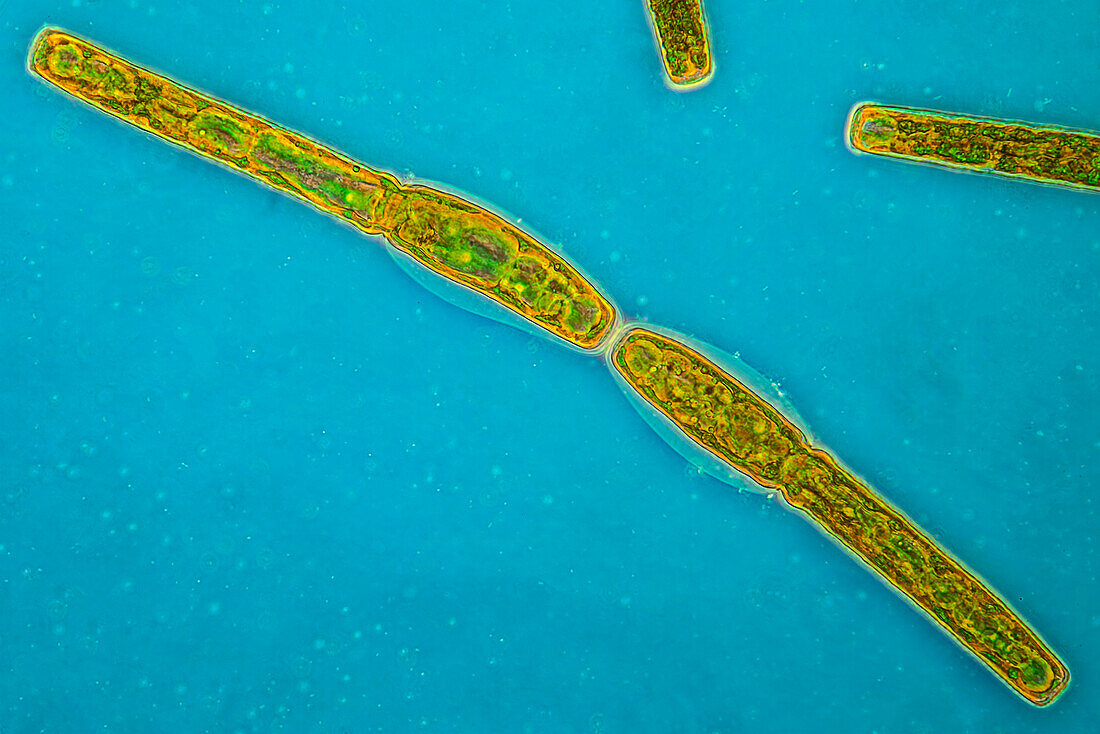 Pleurotaenium ehrenbergii algae, light micrograph