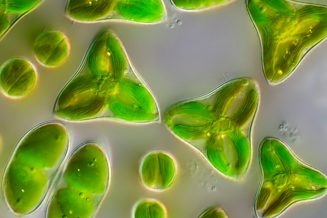 Staurodesmus dickiei algae, light micrograph