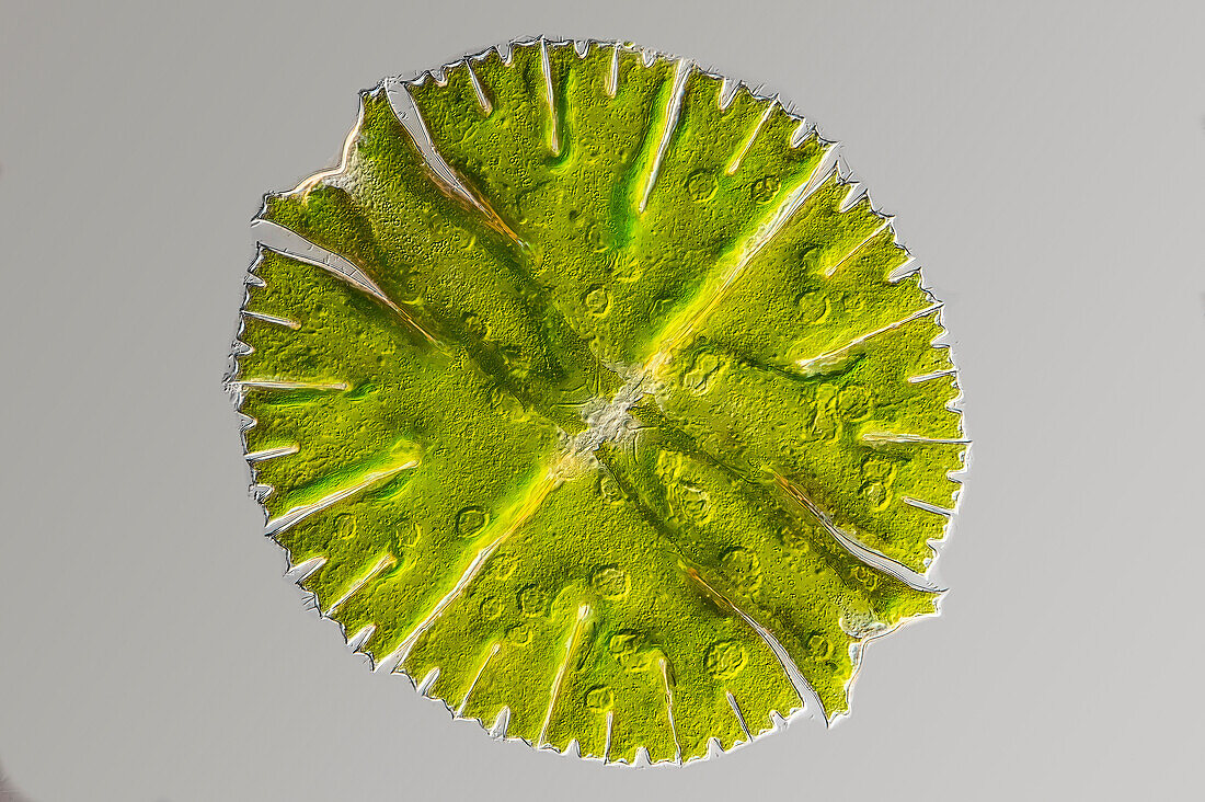 Micrasterias rotata algae, light micrograph