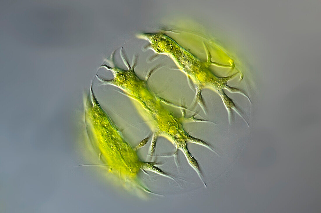 Stephanosphaera pluvialis algae, light micrograph