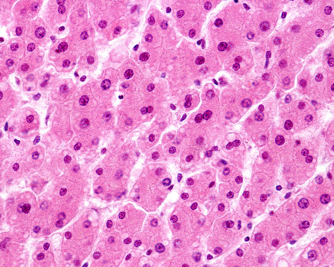 Human liver, light micrograph