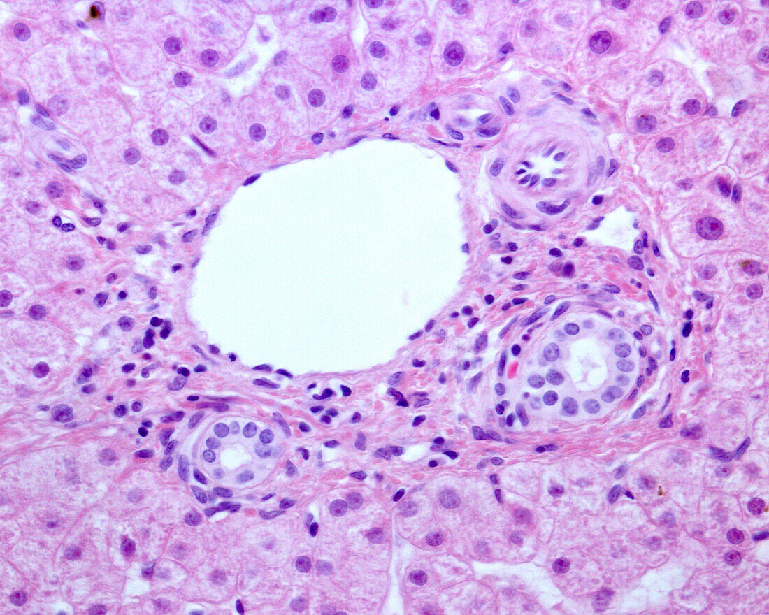 Portal area of human liver, light micrograph