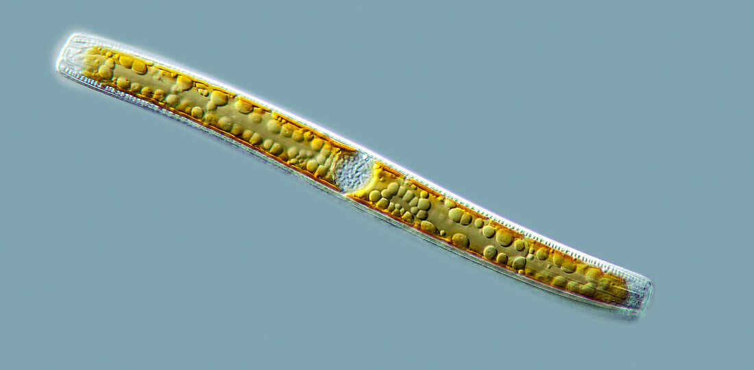 Nitzschia freshwater diatom, light micrograph