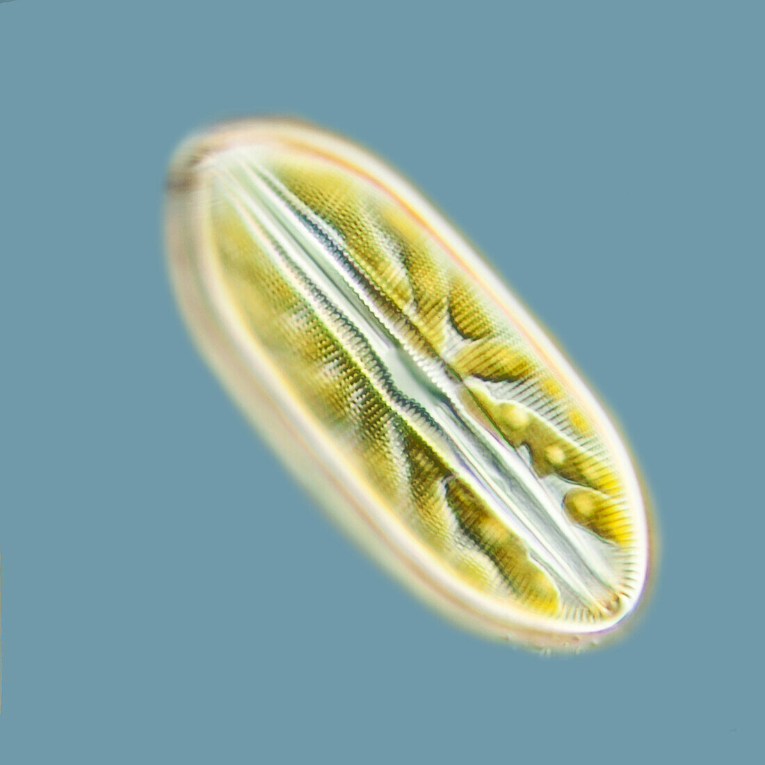 Diploneis freshwater diatom, light micrograph