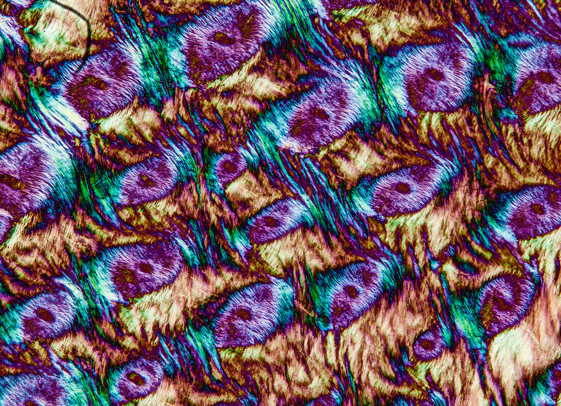 Horse hoof, light micrograph