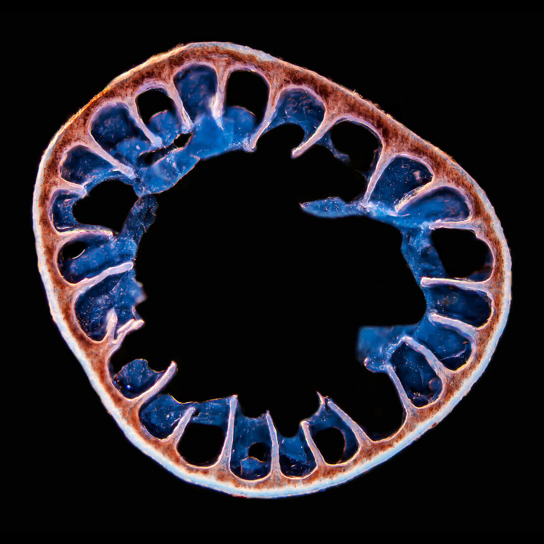 Hedgehog spine, light micrograph
