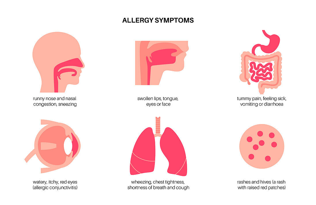 Allergy symptoms, conceptual illustration