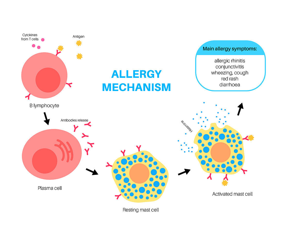 Allergy mechanism, illustration