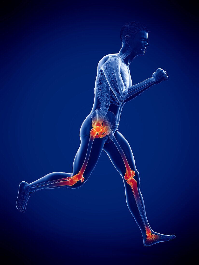 Runner's painful joints, illustration