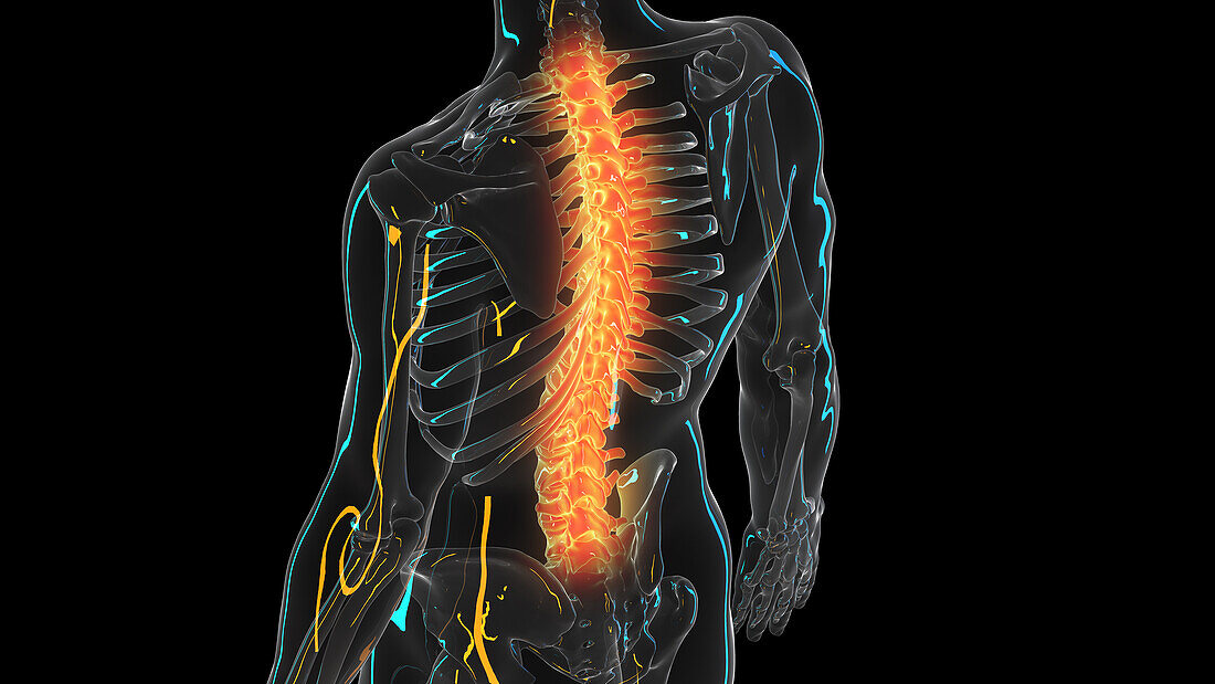 Painful back, illustration