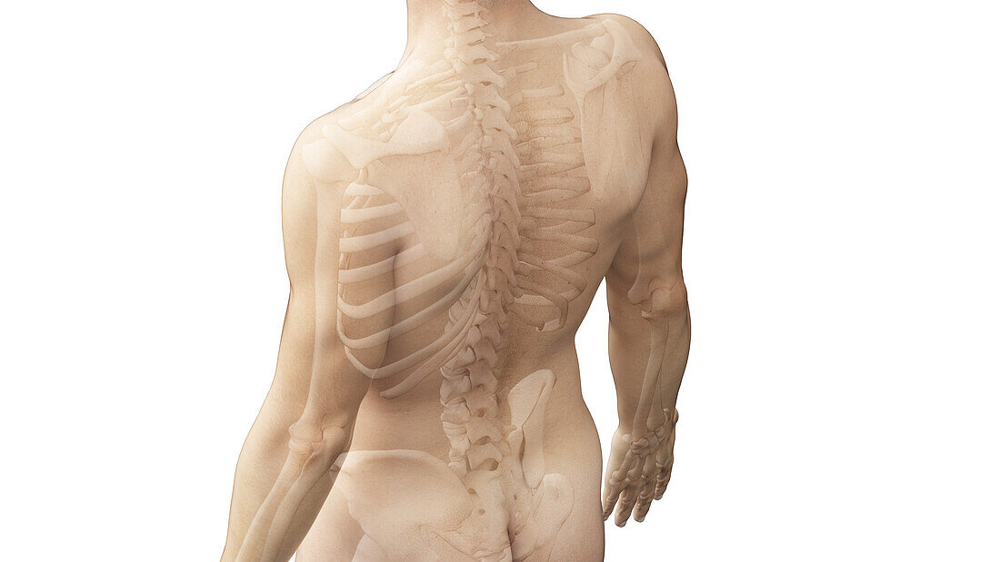 Painful back, illustration