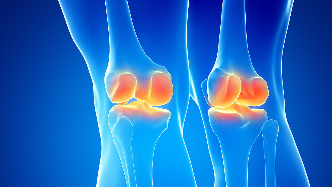 Painful knee joints, illustration