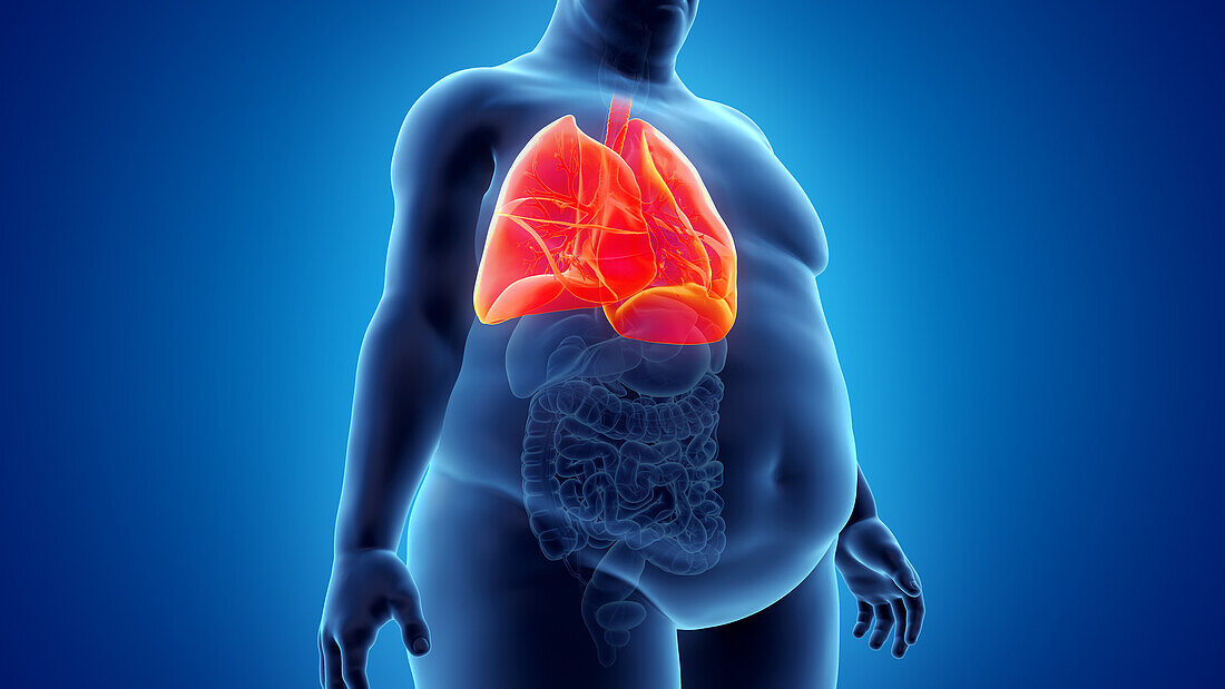 Obese man's lung, illustration