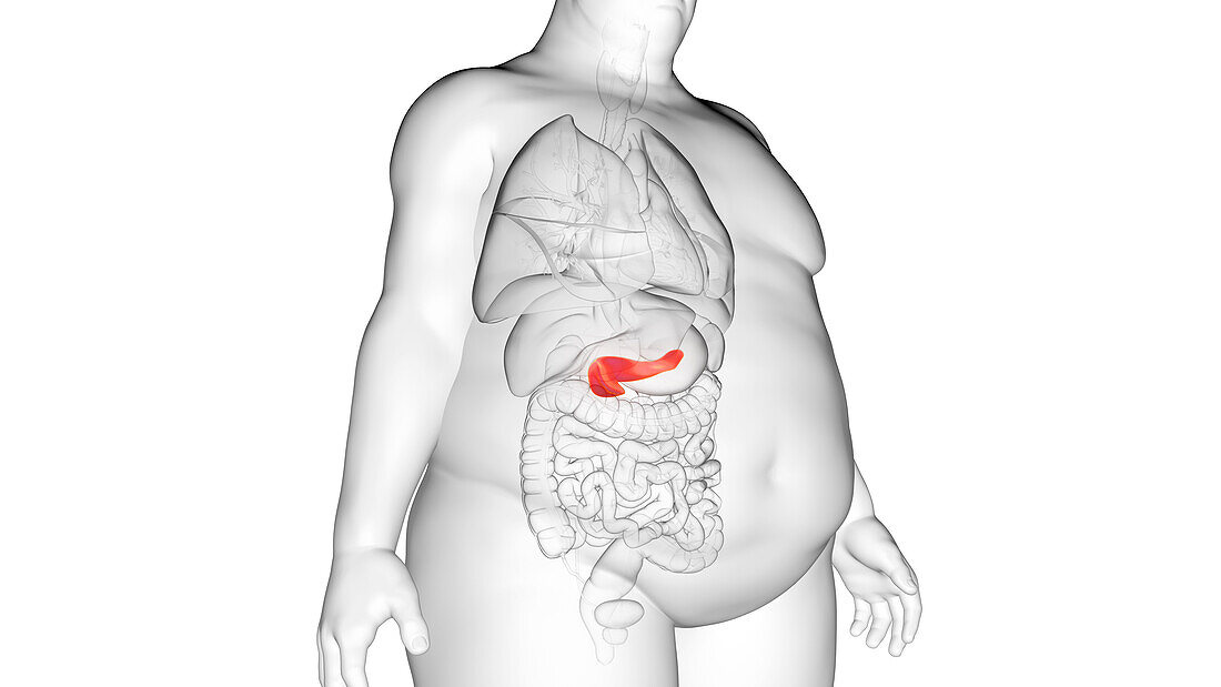 Obese man's pancreas, illustration