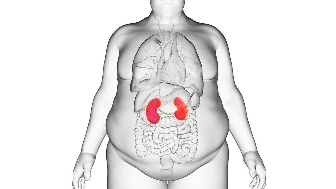 Obese man's kidneys, illustration