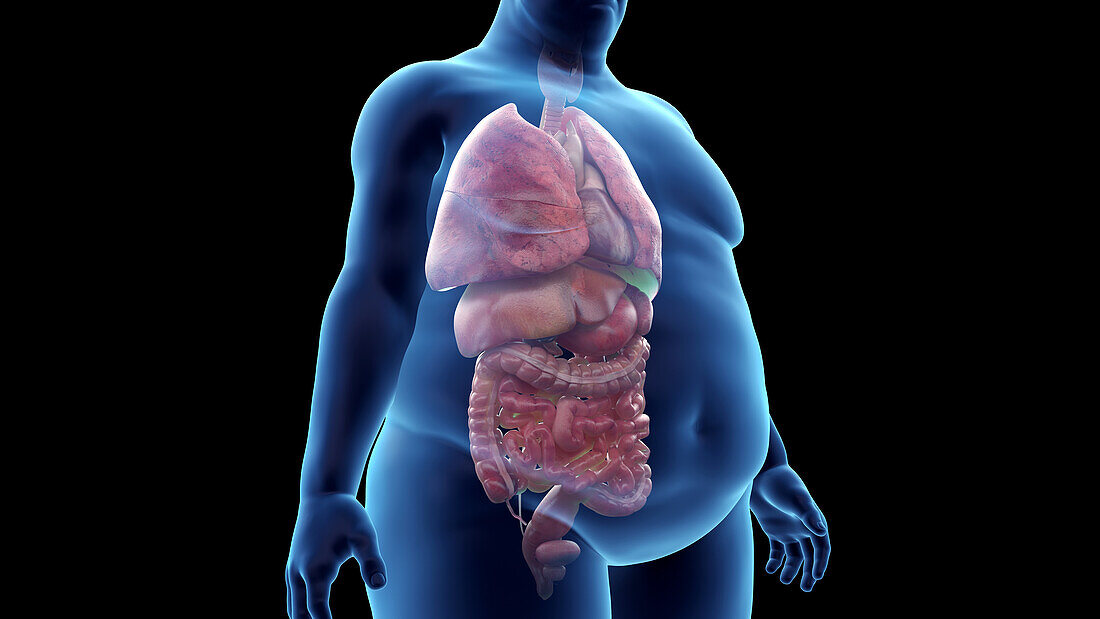 Obese man's organs, illustration