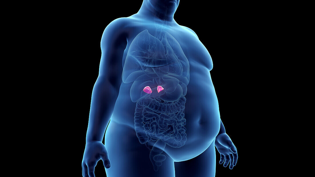 Obese man's adrenal glands, illustration