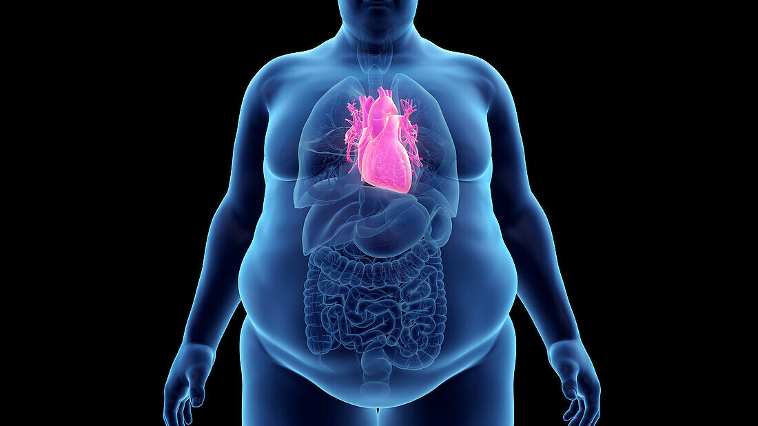 Obese man's heart, illustration