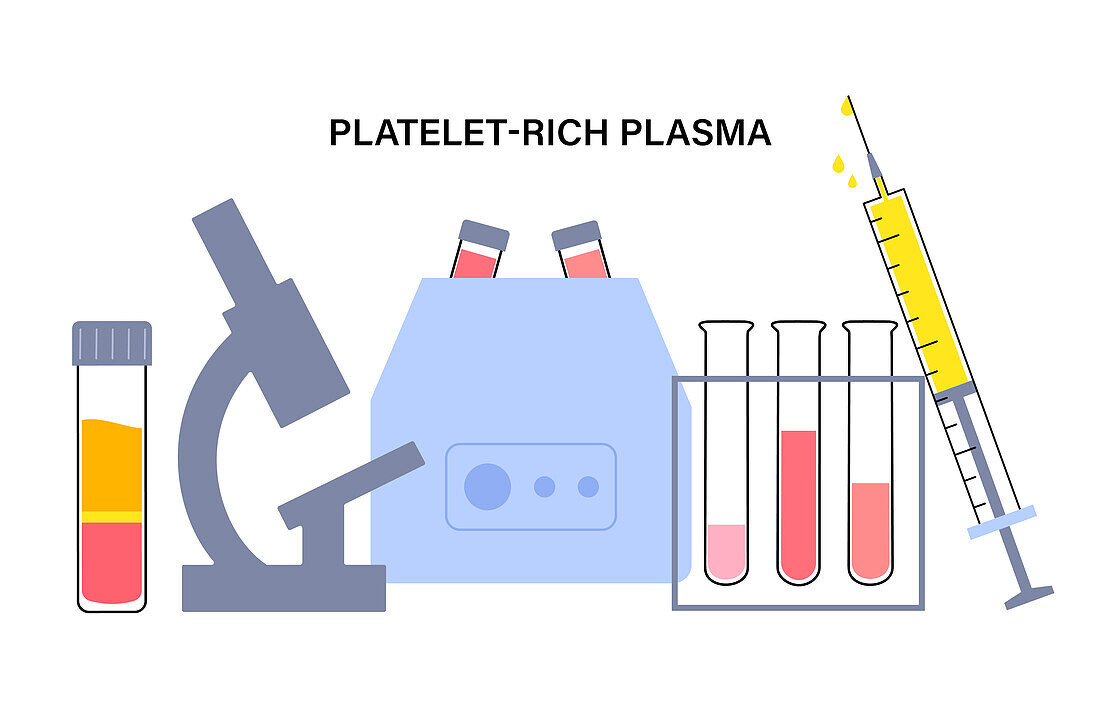 Platelet rich plasma therapy, illustration