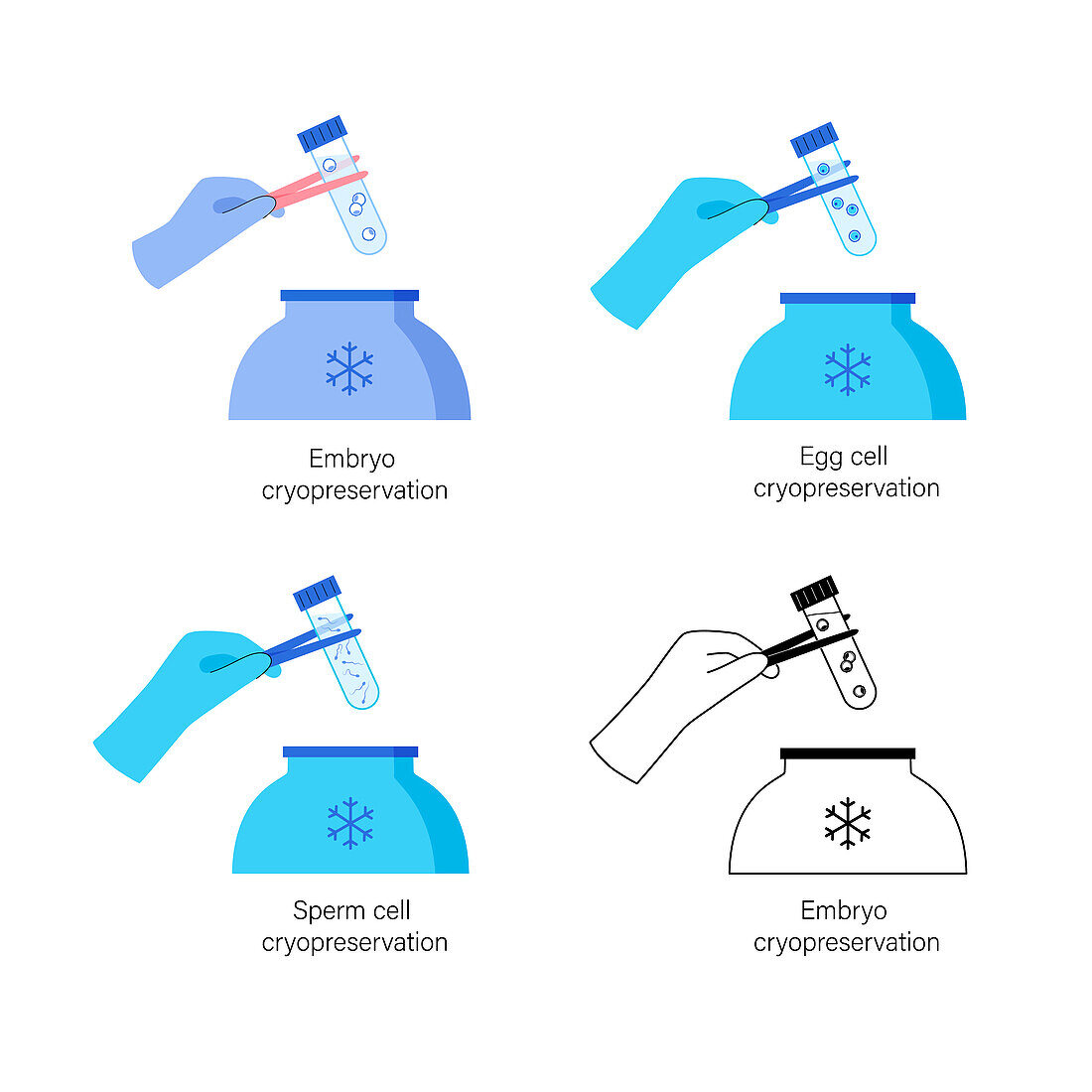 IVF specimen cryopreservation, illustration