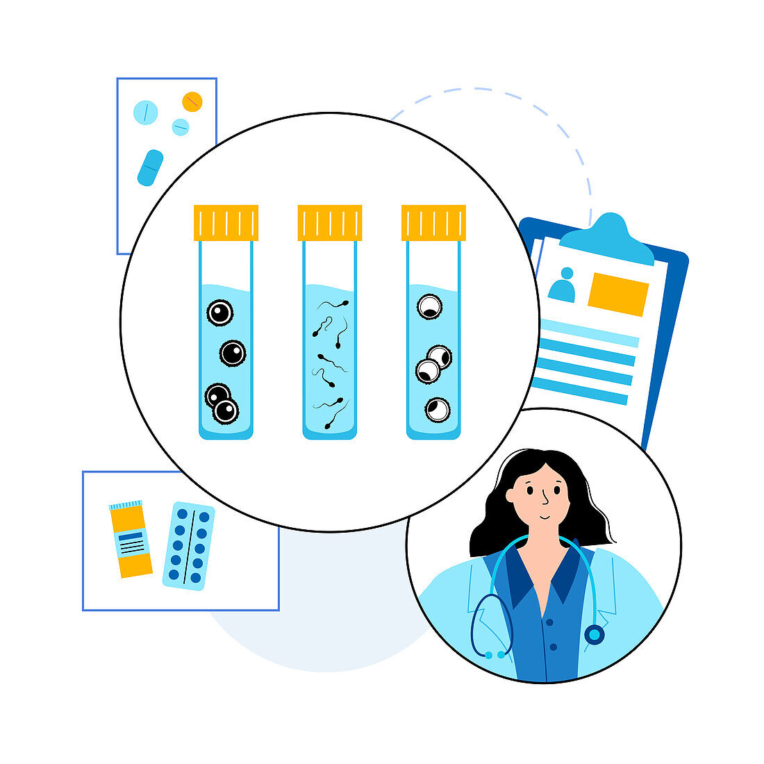 IVF specimen collection, conceptual illustration