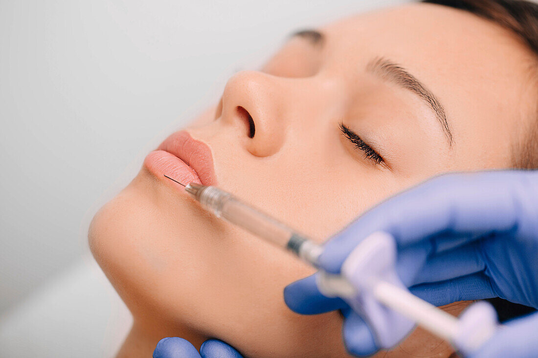 Lip augmentation injection