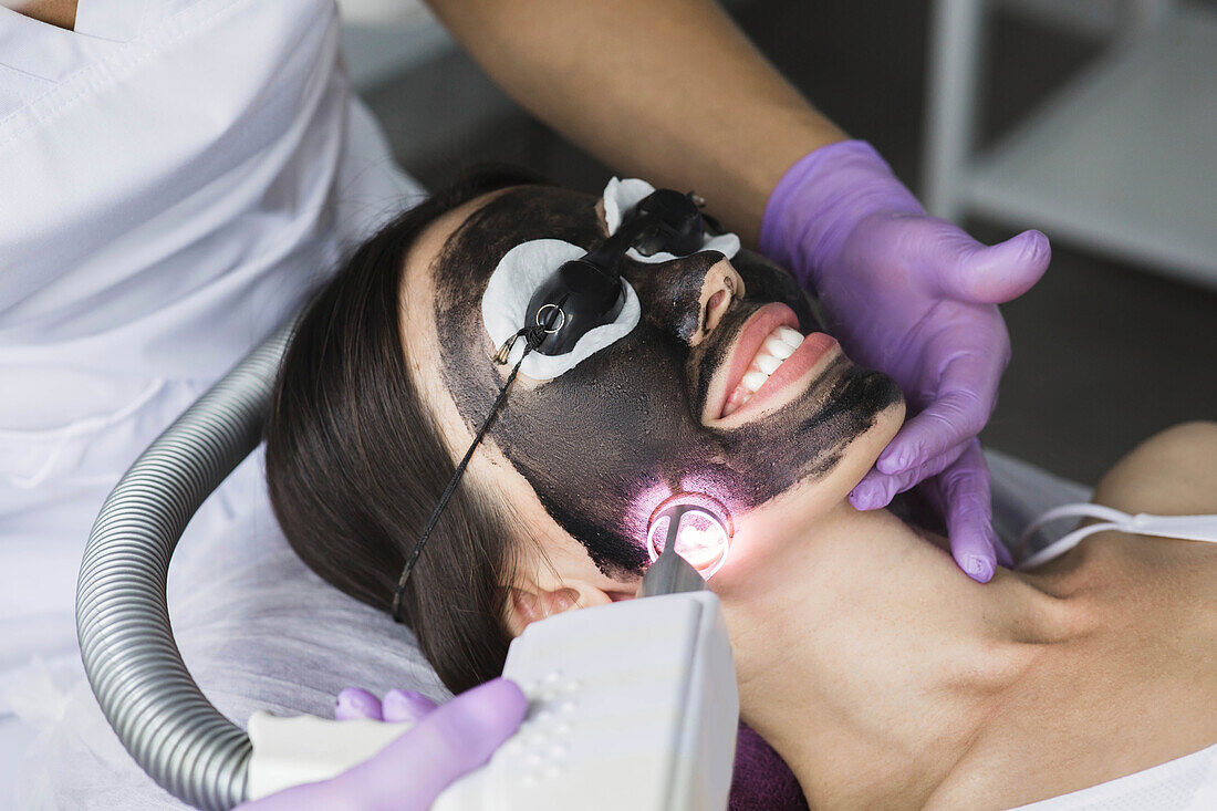 Carbon laser peel