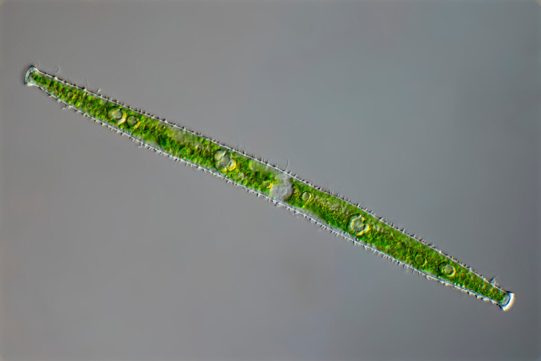 Gonatozygon brebissonii, algae, light micrograph