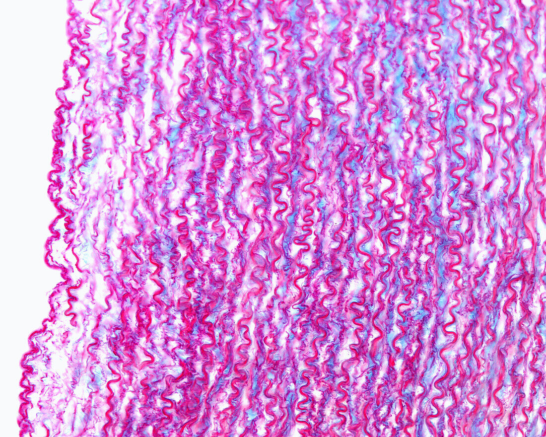 Elastic lamellae in aorta, light micrograph