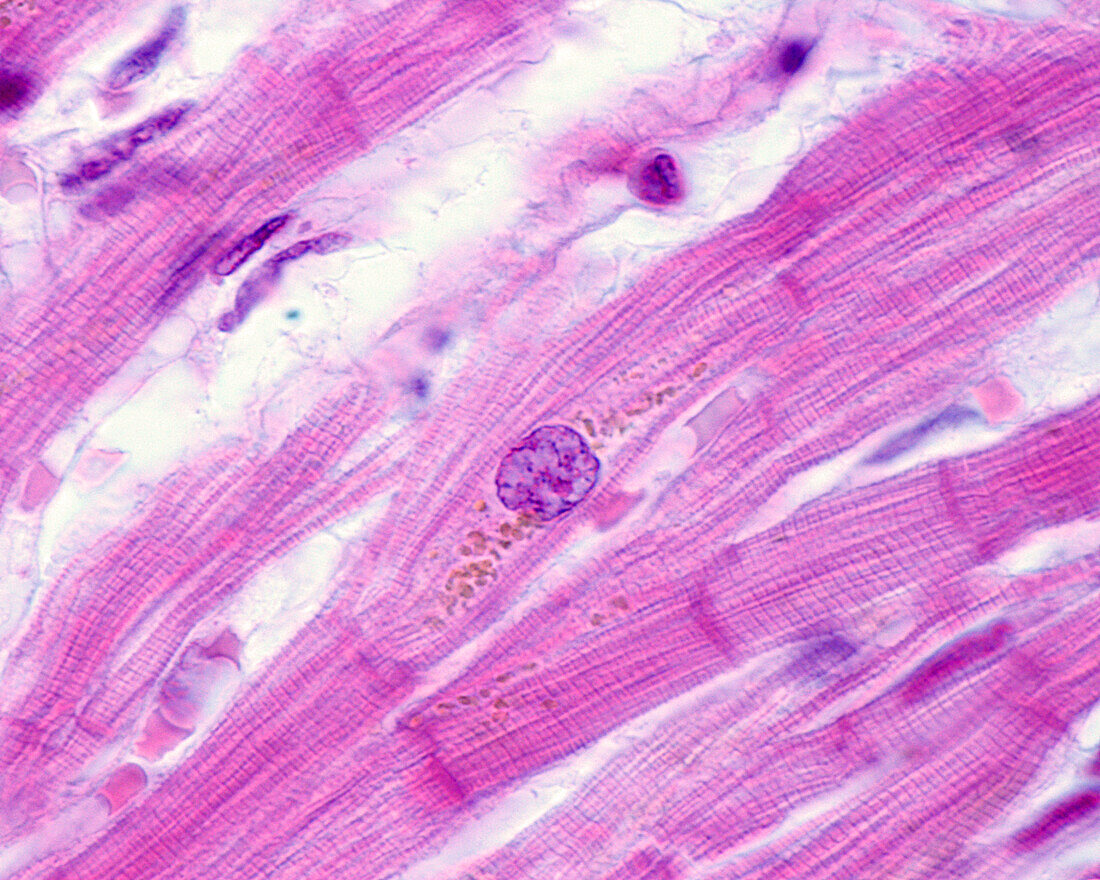 Lipofuscin in heart muscle cells, light micrograph