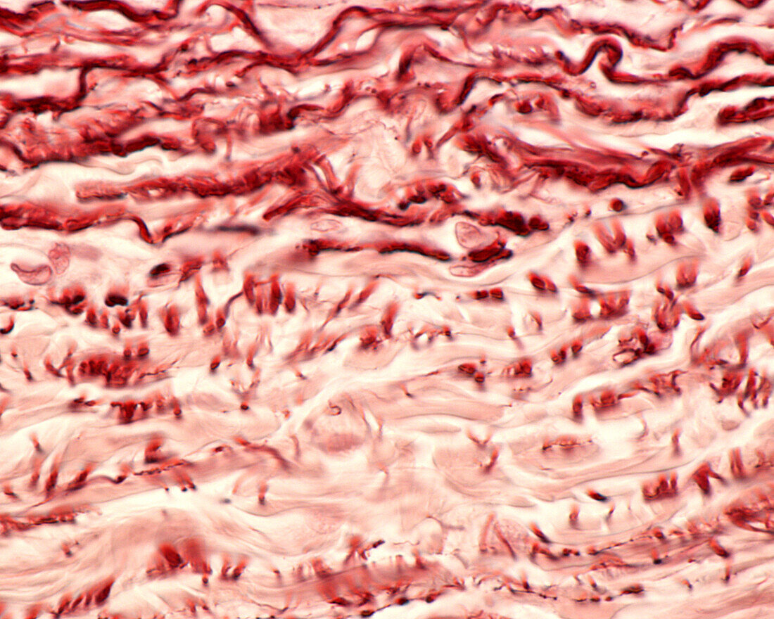 Human aorta, light micrograph