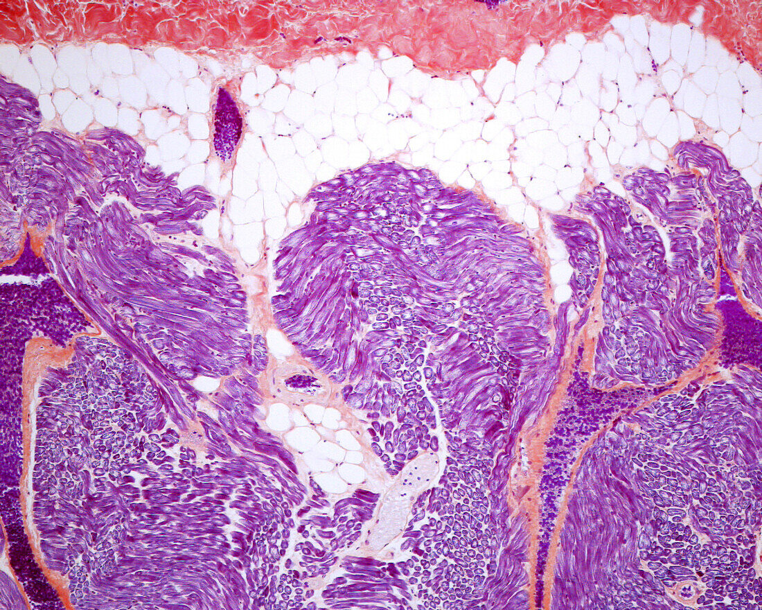 Heart pericardium, light micrograph
