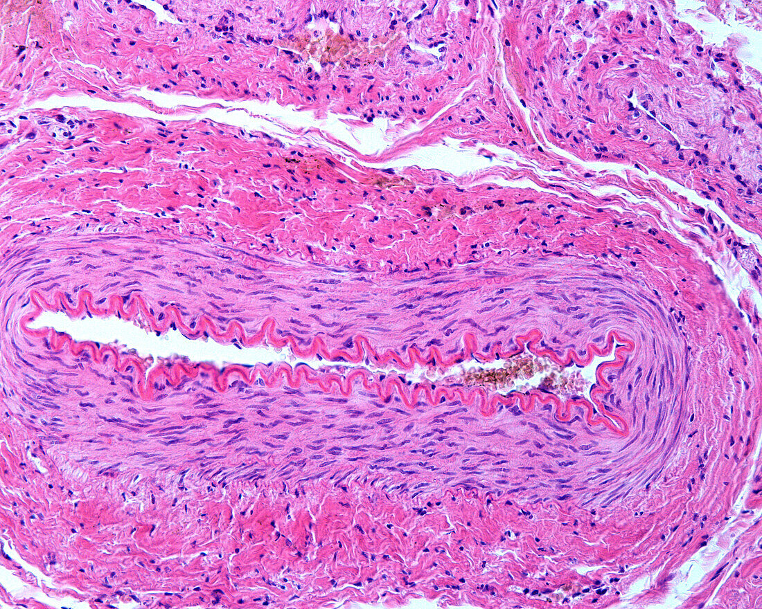 Muscular artery wall, light micrograph