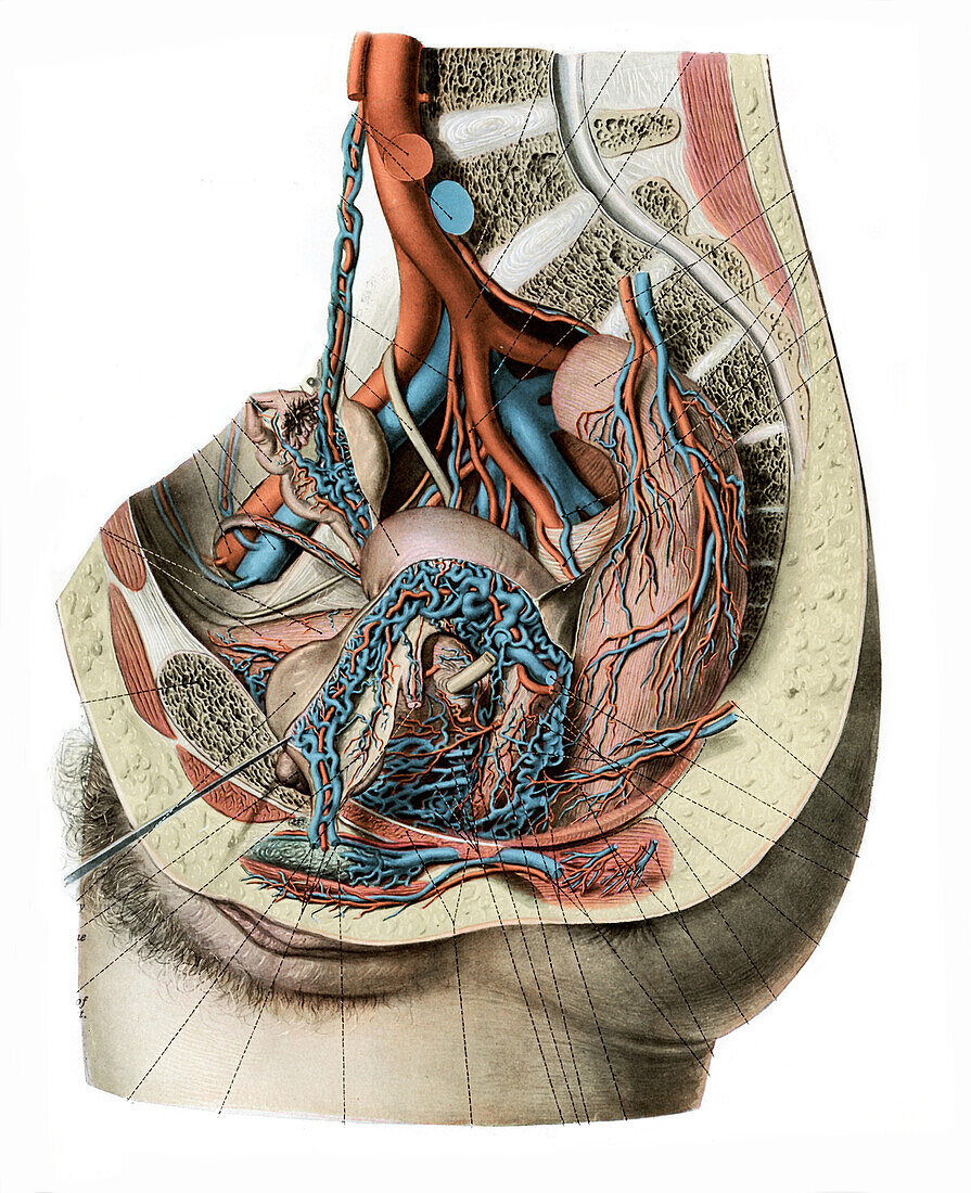 Female pelvic vessels, illustration