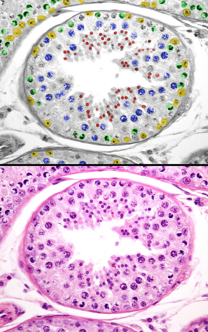 Spermatogenesis in human testicle, light micrographs